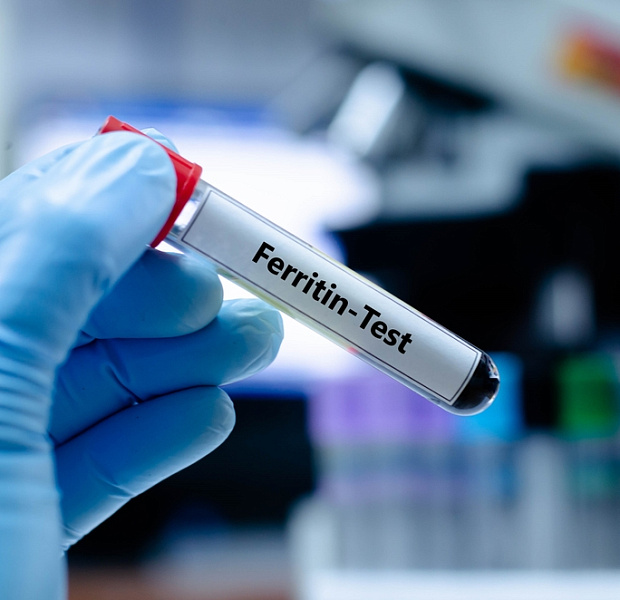 Предиктивное значение ферритина у пациентов с метаболически ассоциированной жировой болезнью печени