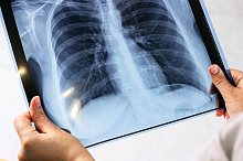 Может ли ранняя АСИТ предотвратить бронхиальную астму в будущем?