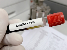 Сифилис и сердечно-сосудистые заболевания: есть ли связь?