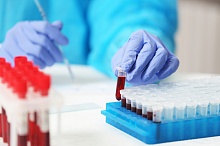 Влияние элтромбопага на результаты лабораторных тестов и повышенный риск гепатотоксичности 