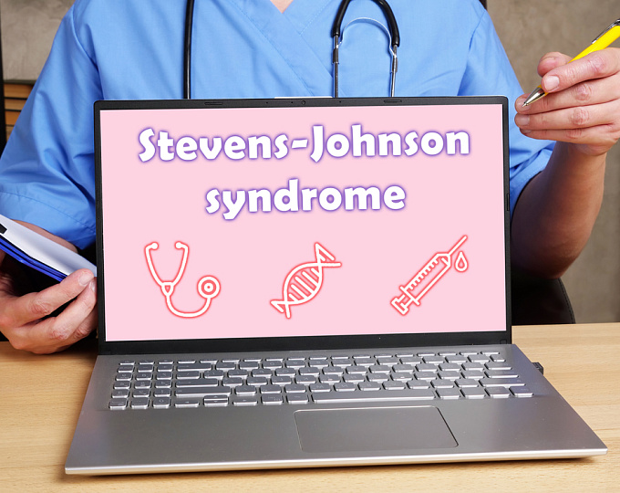 Распространенность антибиотикоассоциированного синдрома Стивенса-Джонсона и синдрома Лайелла