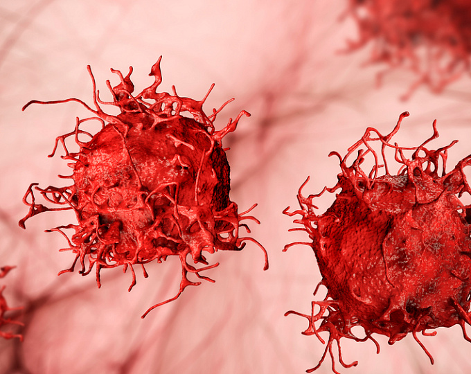 Венозные тромбоэмболии при онкологических заболеваниях: ПОАК против НМГ