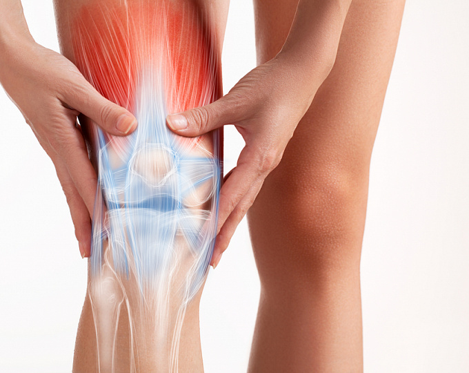 Превосходит ли лечебная физкультура инъекции кортистероидов при остеоартрите коленного сустава?