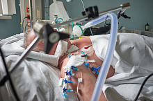 Роль ацикловира в снижении заболеваемости и смертности у пациентов, находящихся на механической вентиляции легких 
