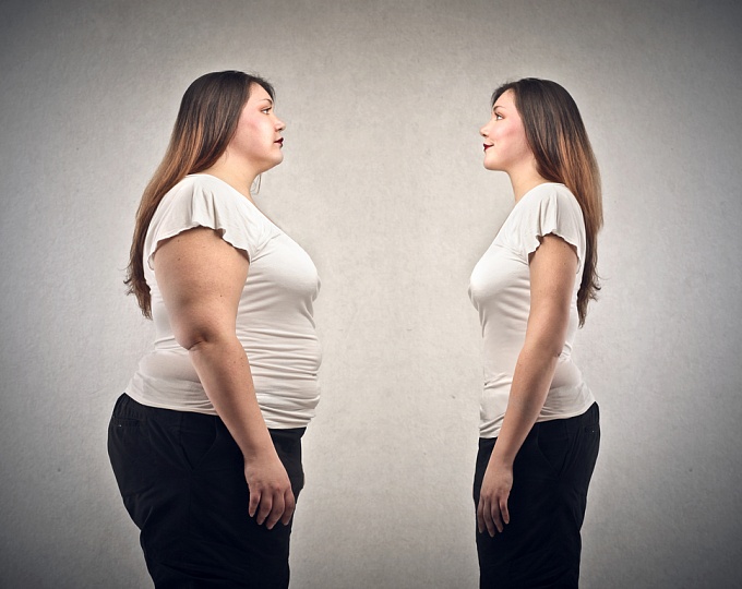 Какие сердечно-сосудистые заболевания скрываются за здоровым фенотипом ожирения?
