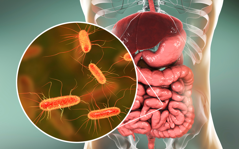 Escherichia coli как фактор риска колоректального рака