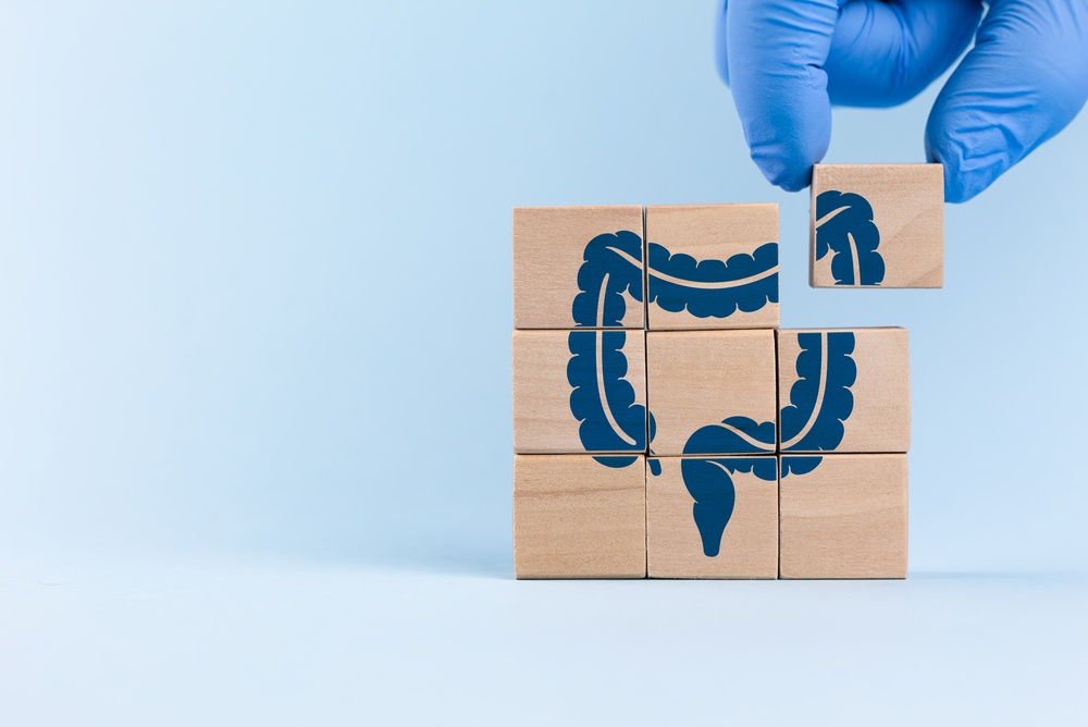 Частота развития кишечной неоплазии у пациентов с воспалительным заболеванием кишечника и дисплазией