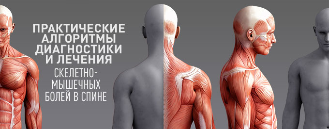Практические алгоритмы диагностики и лечения скелетно-мышечных болей в спине