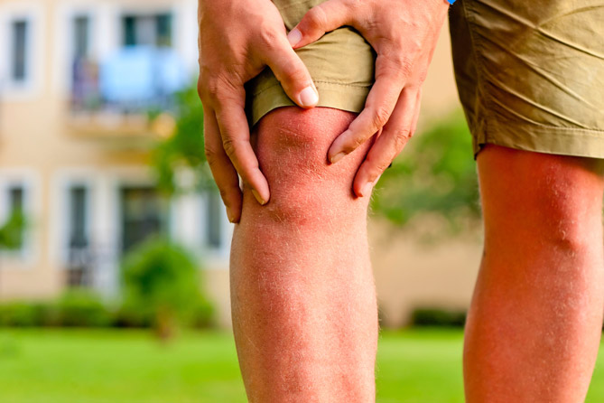 Хондроитин сульфат в лечении пациентов с остеоартритом коленных суставов