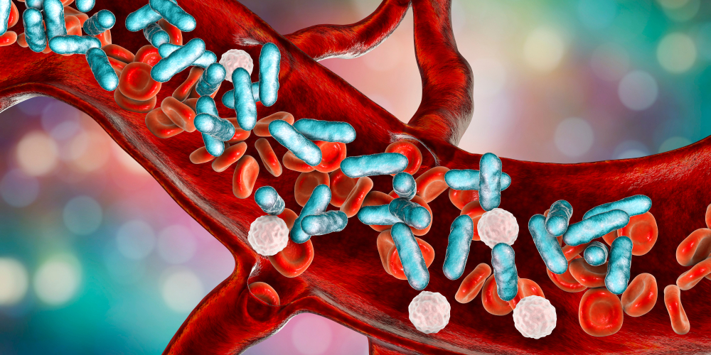 Эффективность комбинированной терапии в лечении бактериемии MRSA поставили под сомнение