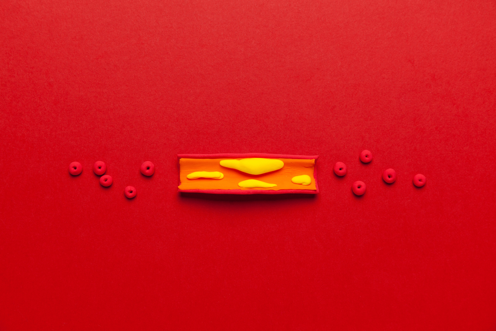 Артериальное давление в подростковом возрасте и атеросклероз в среднем возрасте: есть ли связь?