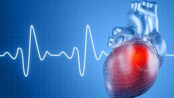 Способы лечения желудочковой тахикардии у пациентов с ишемической кардиомиопатией