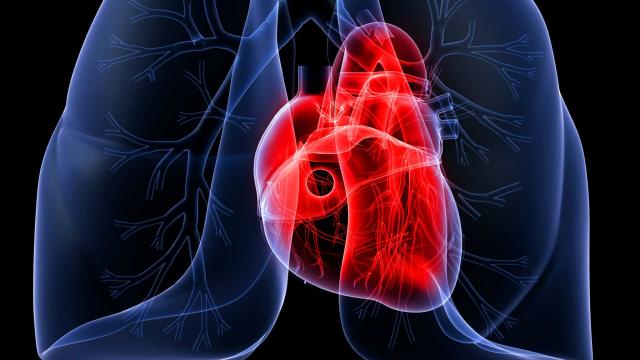 Риск развития сердечной недостаточности после перенесенной внебольничной пневмонии