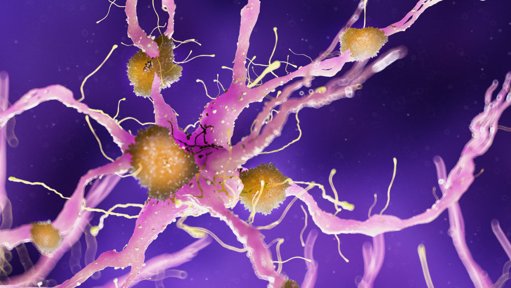 Новые возможности терапии транстиретинового амилоидоза