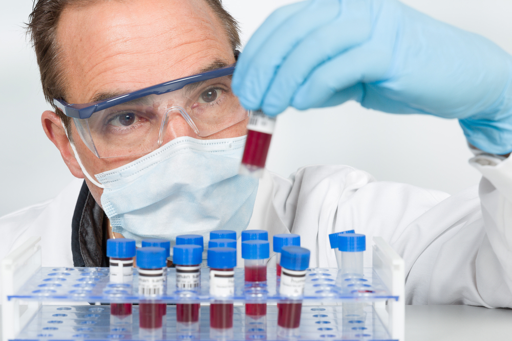 Ингибиторы PCSK9 при COVID-19: результаты рандомизированного исследования