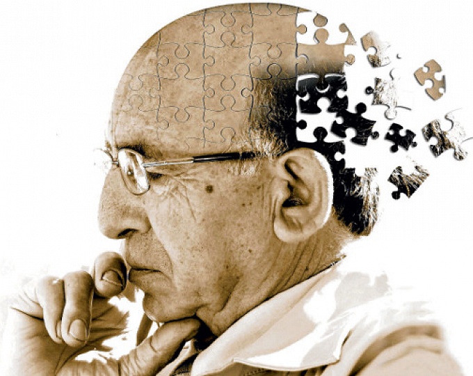 Болезнь Альцгеймера и сердечно-сосудистые заболевания