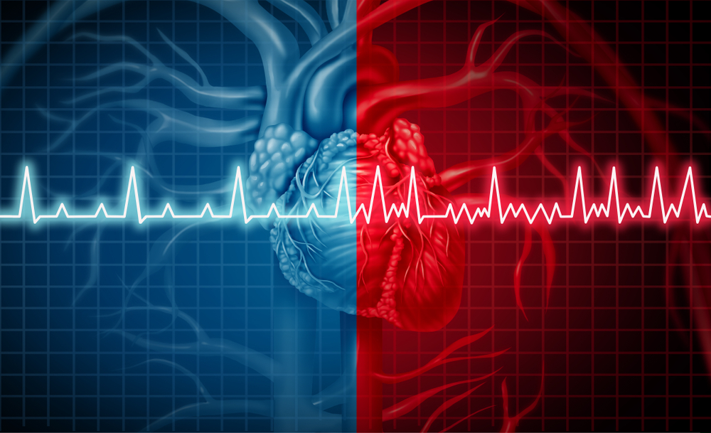 Рекомендации ESC/EACTS 2020 по диагностике и ведению пациентов с фибрилляцией предсердий: обзор изменений