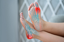 Ингибиторы SGLT2 снижают потребность в препаратах для лечения подагры