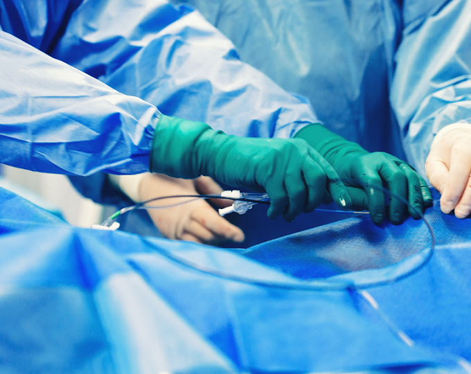 Стентирование коронарных артерий: что о нем думают пациенты?