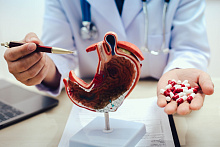 Риск развития аденокарциномы желудка на фоне длительной антисекреторной терапии ингибитором протонной помпы