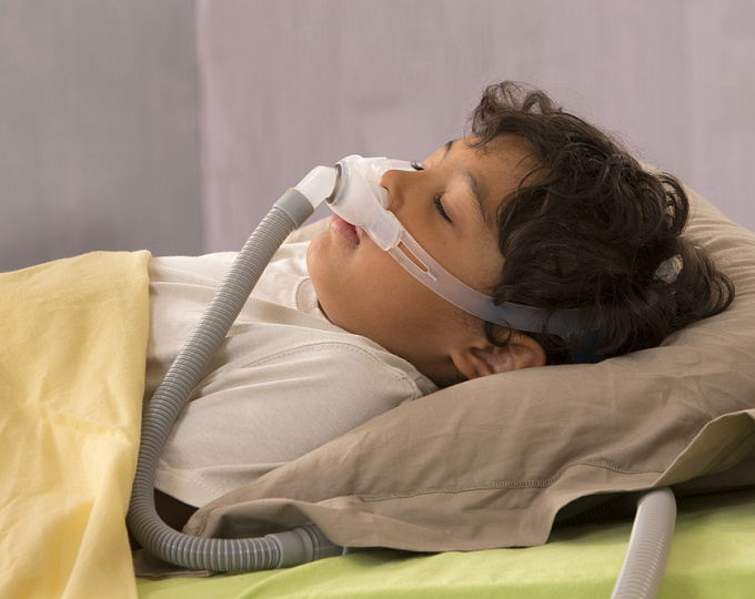 Интраназальные ГКС в лечении обструктивного апноэ сна у детей