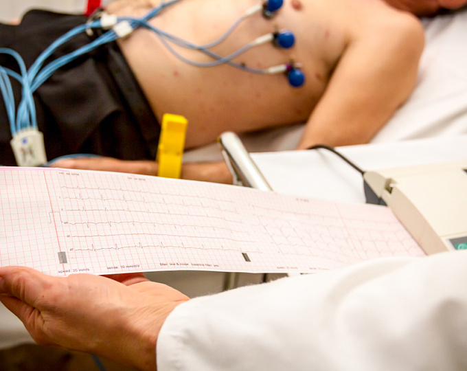 Прогностическое значение изменений на ЭКГ у пациентов с АНЦА-ассоциированными васкулитами