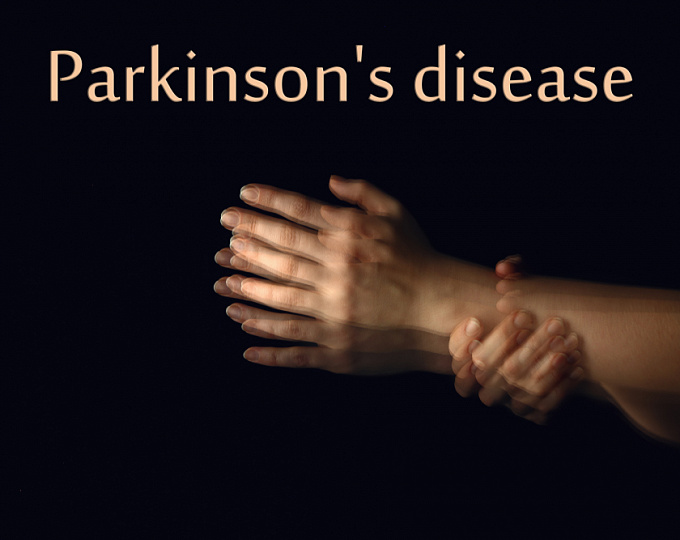 COVID-19 связан с повышенным риском развития болезни Паркинсона