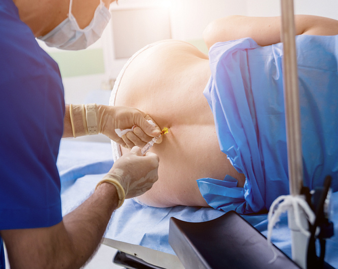 Вклад эпидуральной анестезии в развитии тяжелых состояний и заболеваний у матери в послеродовом периоде