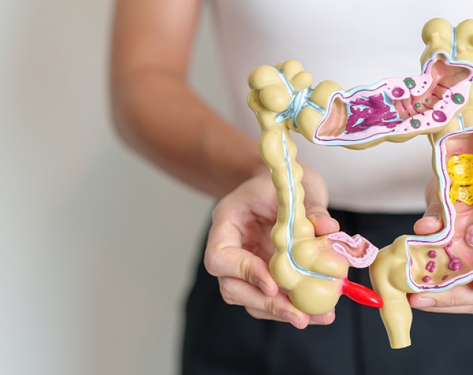 Целесообразно ли выполнение колоноскопии после эпизода дивертикулита?