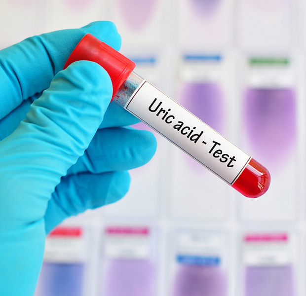 Связь между уровнем мочевой кислоты и риском развития осложнений у молодых пациентов с сахарным диабетом 1 типа