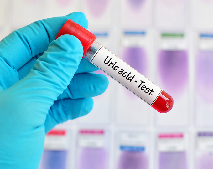 Связь между уровнем мочевой кислоты и риском развития осложнений у молодых пациентов с сахарным диабетом 1 типа