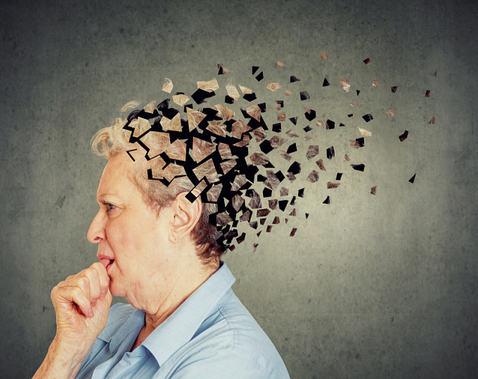 Может ли антигипертензивная терапия снизить риск болезни Альцгеймера?  