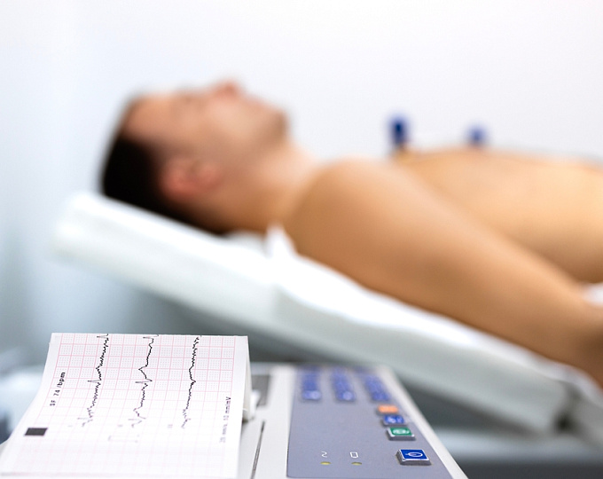 Альбуминурия и сердечно-сосудистые события у пациентов с начальной хронической болезнью почек