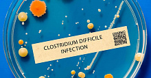 Сравнение риска инфекции Clostridium difficile на фоне антисекреторных препаратов