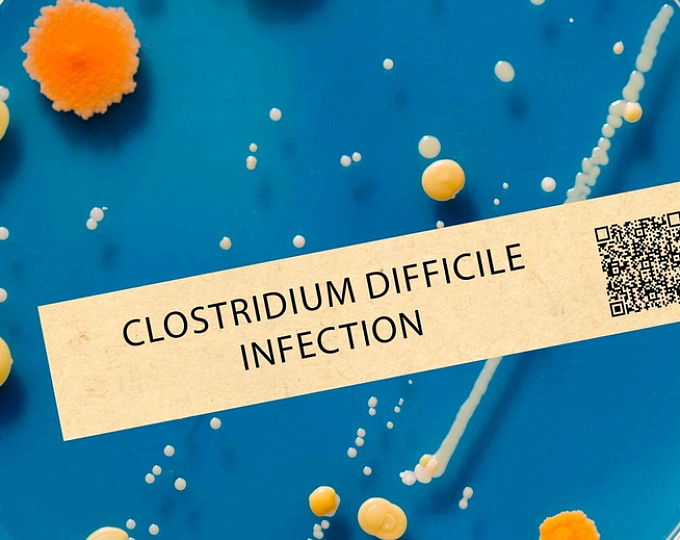 Сравнение риска инфекции Clostridium difficile на фоне антисекреторных препаратов