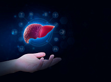 Риск гепатоцеллюлярной карциномы у ВИЧ-инфицированных пациентов после прямой противовирусной терапии хронического гепатита C