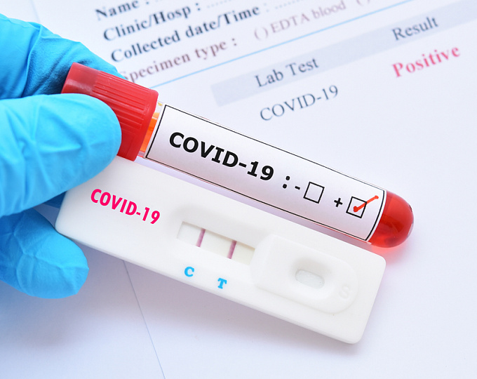 Как COVID-19 влияет на прогрессирование нарушений углеводного обмена при предиабете?