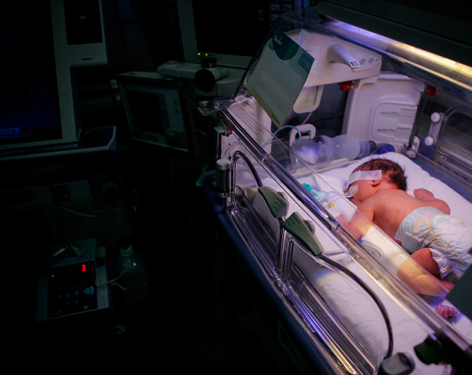 Имеет ли значение пороговый уровень гемоглобина при трансфузии у новорожденных с низким весом?