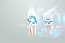 Какие факторы определяют успешность эндопротезирования коленного сустава?