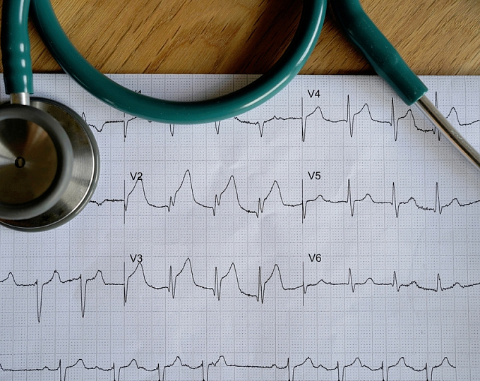 Оптимальная антитромботическая терапия после закрытия ушка левого предсердия