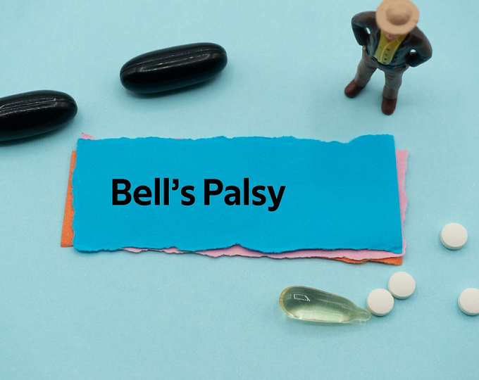 Эффективность преднизолона при параличе Белла у детей