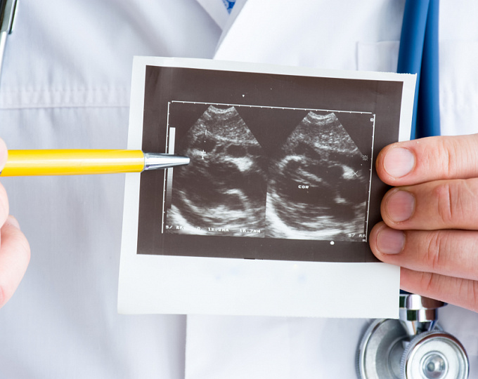 Каков прогноз пациентов с перикардитом?