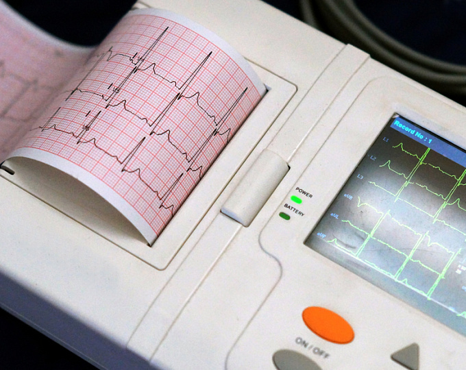Исследователи стремятся расширить горизонты скрининга QTc
