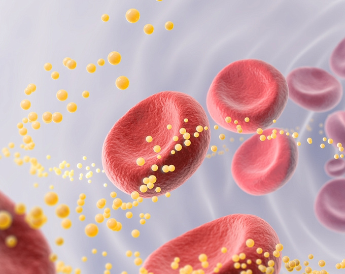 Можно ли считать высокоинтенсивную гиполипидемическую терапию эталоном при атеросклеротических ССЗ?