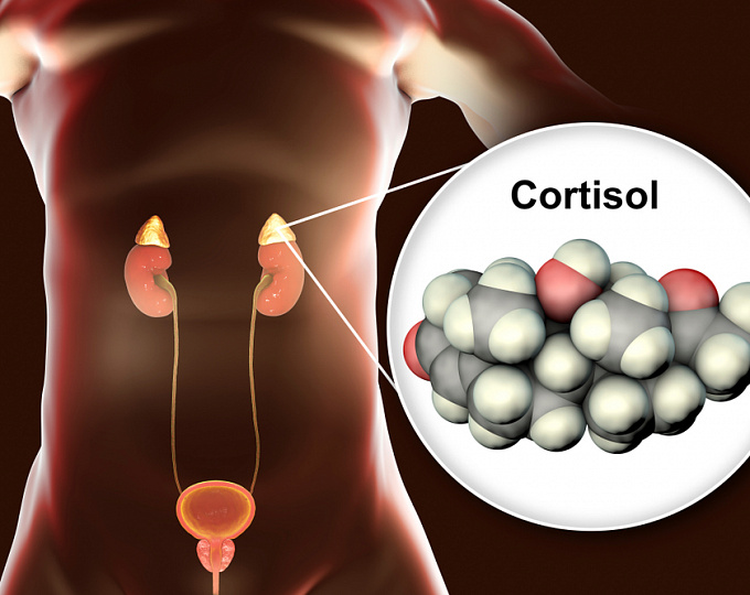 В чем кроется опасность адренальной инциденталомы?