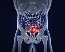 Колоректальный рак молодеет, картина глобальной катастрофы