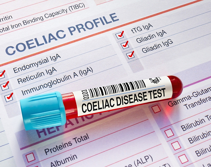 Можно ли установить диагноз целиакии без биопсии двенадцатиперстной кишки?