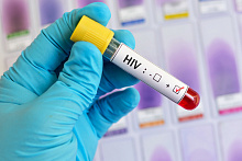Глобальная распространенность ВИЧ-ассоциированных неходжкинских лимфом