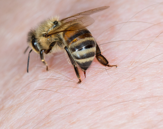 Кому показана десенсибилизация после укуса осы или пчелы?