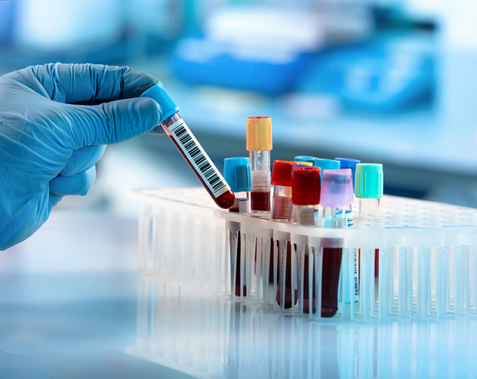 Влияние биотина на результаты лабораторных тестов